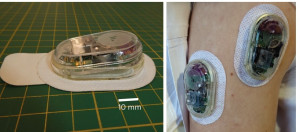 Έξυπνο τσιρότο μπορεί να κάνει τα φάρμακα πιο ασφαλή και πιο αποτελεσματικά