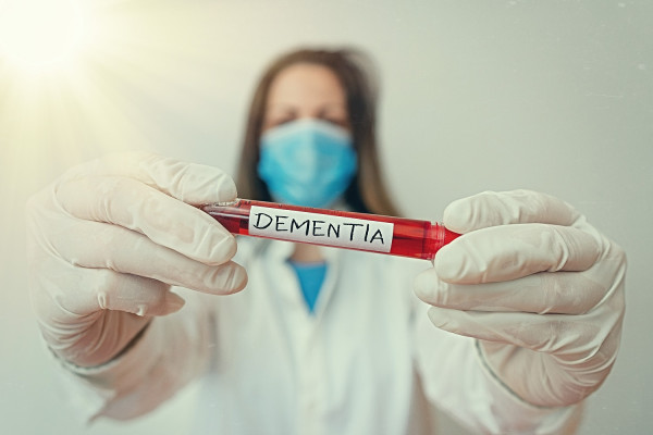Η εξέταση αίματος Roche - Lilly για τη διάγνωση της νόσου του Alzheimer έλαβε έγκριση στις ΗΠΑ