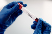 Τα 2 βασικά μειονεκτήματα των rapid τεστ για τη διάγνωση του ιού