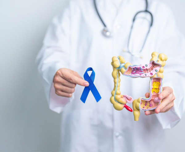 Γιατί αυξάνεται στα άτομα κάτω των 50 ο καρκίνος του παχέος εντέρου;