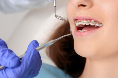 Πως επηρεάζει τη στοματική υγεία η κακή σύγκλειση των δοντιών