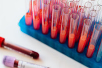 Bristol Myers Squibb: Επιστημονική πρωτοβουλία για την επάρκεια του αίματος