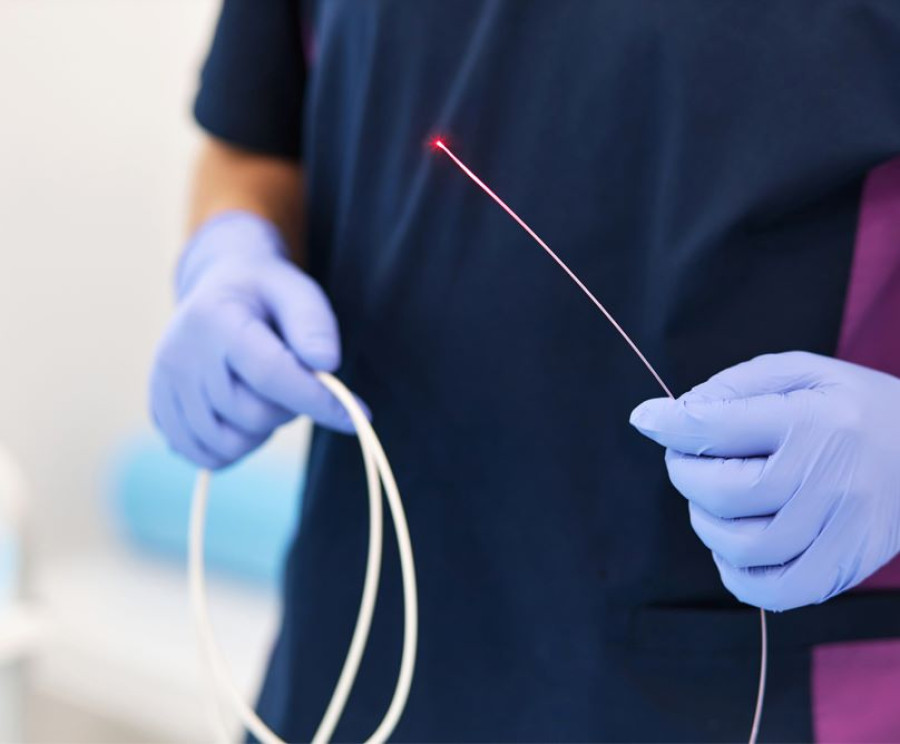 Ενδοαυλική θεραπεία με laser για την αντιμετώπιση κιρσών και φλεβικής ανεπάρκειας