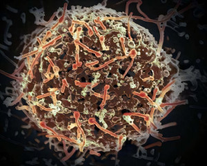 Πειραματικό εμβόλιο mRNA εμφανίζεται πολλά υποσχόμενο κατά πολλών στελεχών του ιού Έμπολα