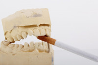 Κάπνισμα: Πέντε τρόποι που βλάπτεις τα δόντια σου