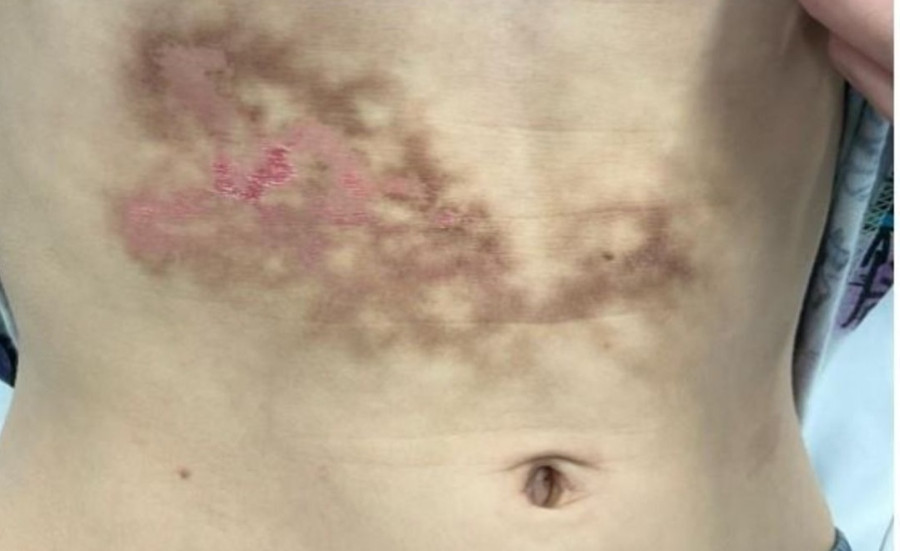 https://casereports.bmj.com/