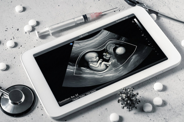 Θεραπεία με βλαστοκύτταρα στα μήτρα μπορεί να αναστρέψει εγκεφαλικές διαταραχές λόγω δισχιδούς ράχης