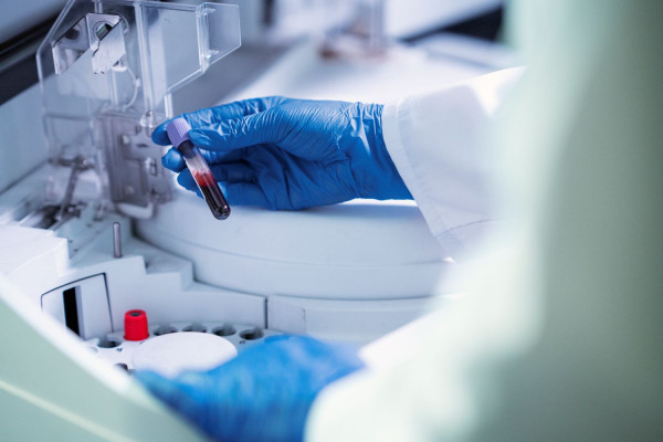 EFPIA: Το «κλειδί» για επενδύσεις άνω των 45 δισ. ευρώ στην έρευνα και την ανάπτυξη στη βιοτεχνολογία